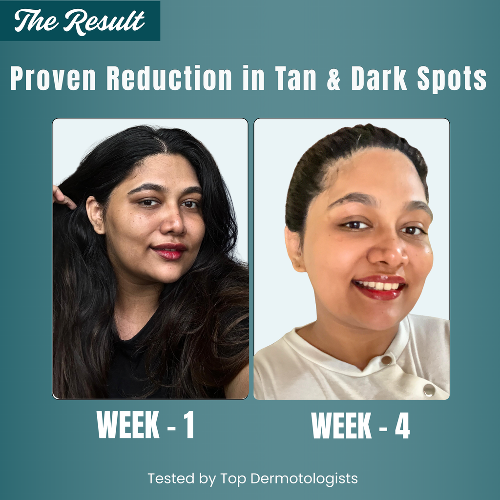 Velva Sunscreen Spray SPF 50 PA++++ | For Men & Women 100ml